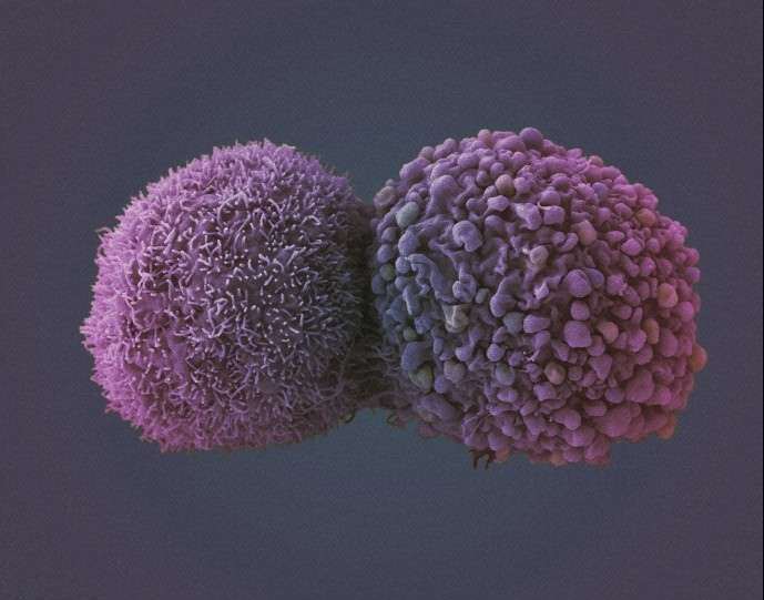 les cellules cancéreuses